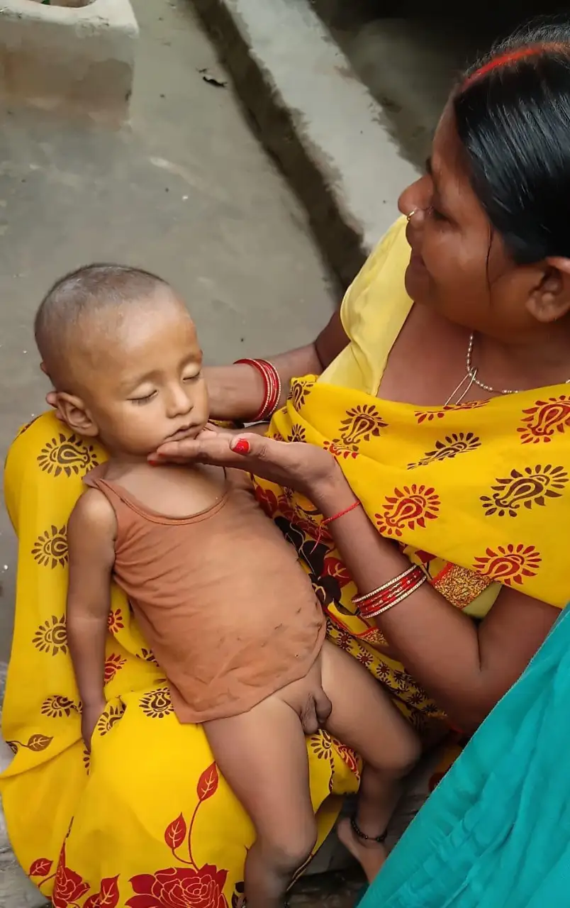 बगहा में दर्दनाक हादसा: घर के पास पानी भरे गड्ढे में डूबने से एक वर्षीय मासूम की मौत, परिवार में मचा कोहराम