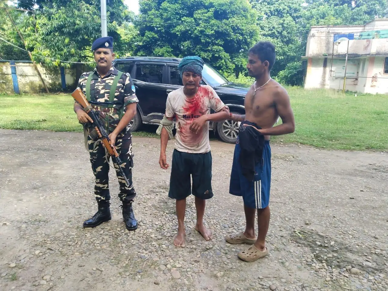 SSB 21वीं वाहिनी ने पुनः पेश की मानवता की मिसाल: VTR में भालू के हमले में घायल नेपाली नागरिक की बचाई जान